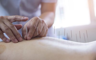 Acupuncture and Post Operative Care